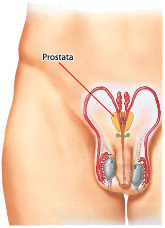prostata2